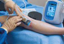 3M to Acquire Wound Care Technology Co., Acelity for $6.7 Billion.