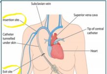 Citius Pharma (CTXR) Corporate Presentation (Jan 2020).