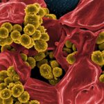 MRSA: Methicillin (antibiotic) Resistant Staphylococcus Aureus.