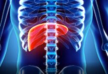 Fatty Liver? 15-25% of the US Population Has It. (Video) Biotech Stock Review, Fatty Liver